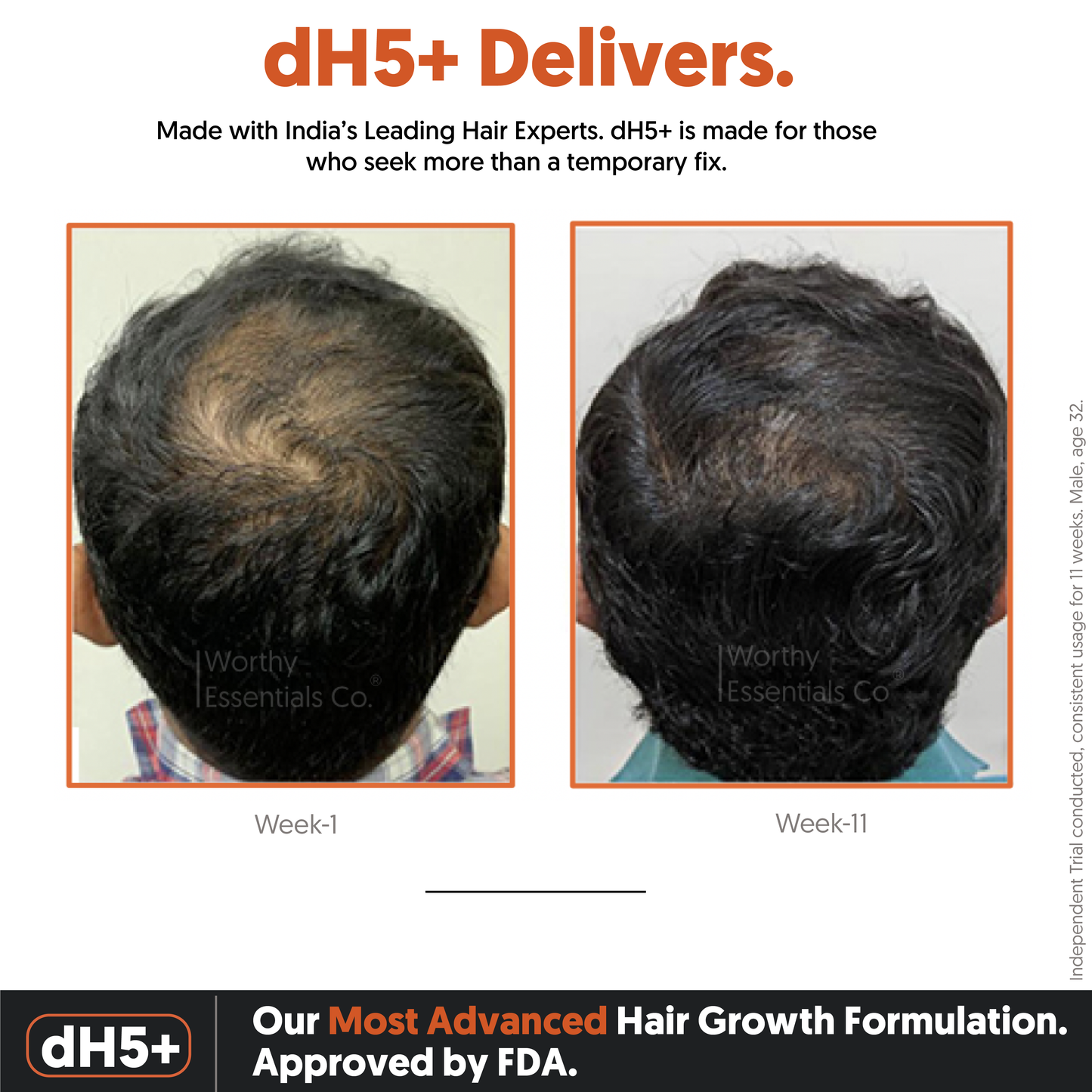 dH5+ Hair Growth Serum