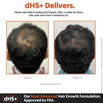 dH5+ Hair Growth Serum